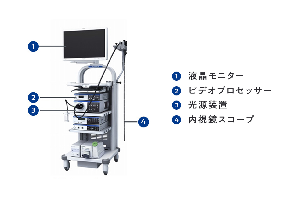 内視鏡検査(胃カメラ・大腸カメラ)