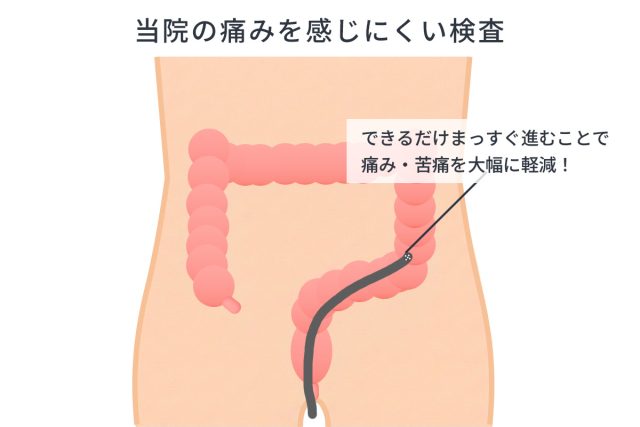 大腸カメラ（大腸内視鏡）検査